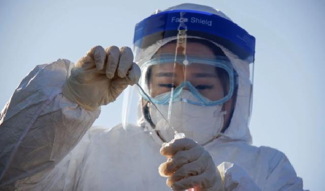 WHO Umumkan Virus Baru Bernama Marburg, Konfirmasi Kematian Pertama di Dunia