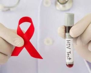 Laki-laki Usia Produktif Paling Banyak Terdampak Kasus AIDS di Riau